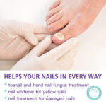 ⁦• NAIL FANGUS SPRAY⁩ - الصورة ⁦8⁩