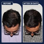 ⁦البخاخ الأمريكي لنمو الشعر FEG⁩ - الصورة ⁦5⁩