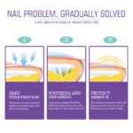 ⁦• NAIL FANGUS SPRAY⁩ - الصورة ⁦2⁩