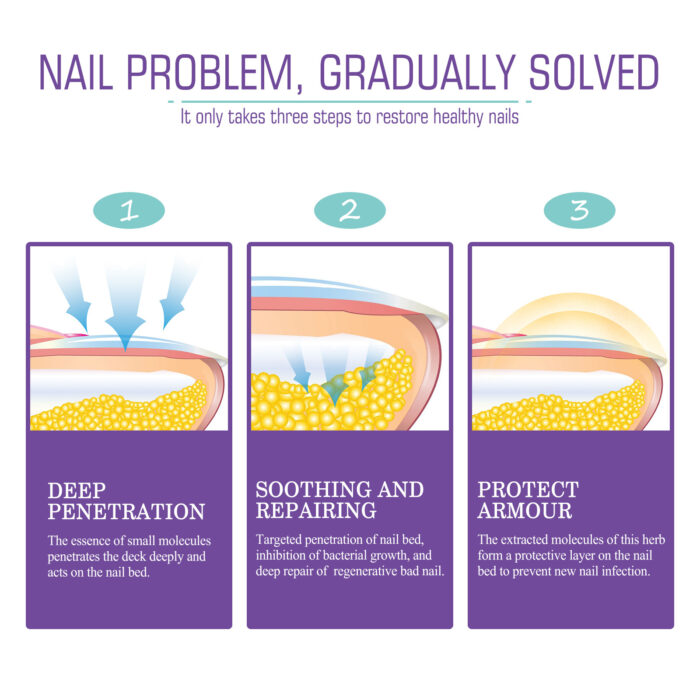 ⁦• NAIL FANGUS SPRAY⁩ - الصورة ⁦2⁩