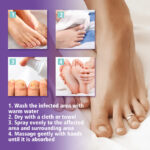 ⁦• NAIL FANGUS SPRAY⁩ - الصورة ⁦6⁩