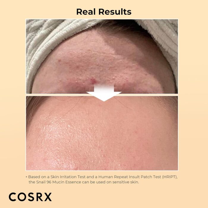 ⁦• CORSX Snail serum⁩ - الصورة ⁦2⁩