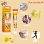 ⁦جل سم النحل السحري لآلام المفاصل⁩ - الصورة ⁦8⁩