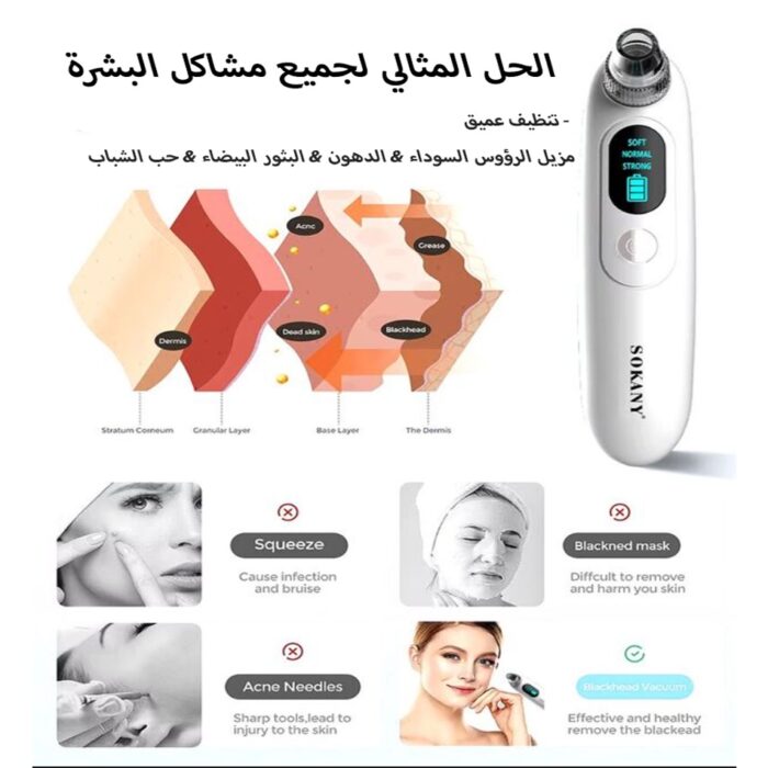 ⁦• جهاز إزالة الرؤوس السوداء من سوكاني⁩ - الصورة ⁦2⁩