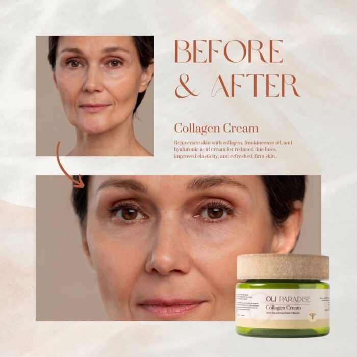 ⁦اولي باراديس كولاجين⁩ - الصورة ⁦4⁩