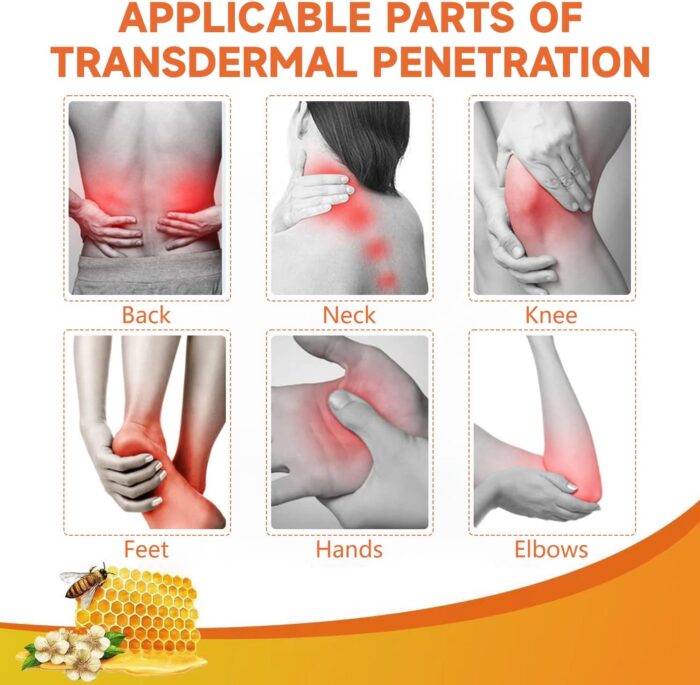 ⁦جل سم النحل السحري لآلام المفاصل⁩ - الصورة ⁦6⁩